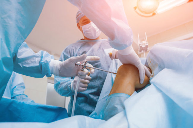 knee-arthroscopy-surgery-benefits