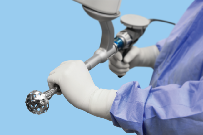 Mako-Robotic-Arm-Assisted-Partial-Knee-Replacement-Results-5yr