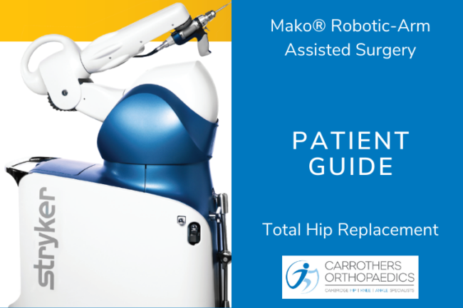 Mako Robotic Assisted Total Hip Replacement Patient Guide Mako robotic surgery equipment