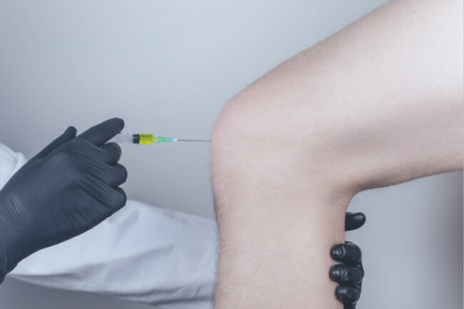 Corticosteroid injections for arthritis Doctor injecting corticosteroids into patient knee