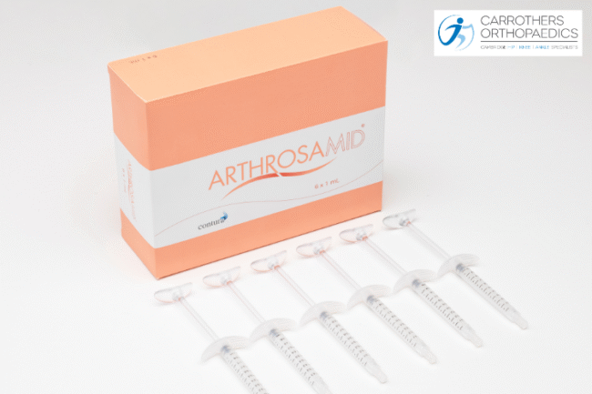 Knee Pain Injections Options Arthrosamid injections for knee pain